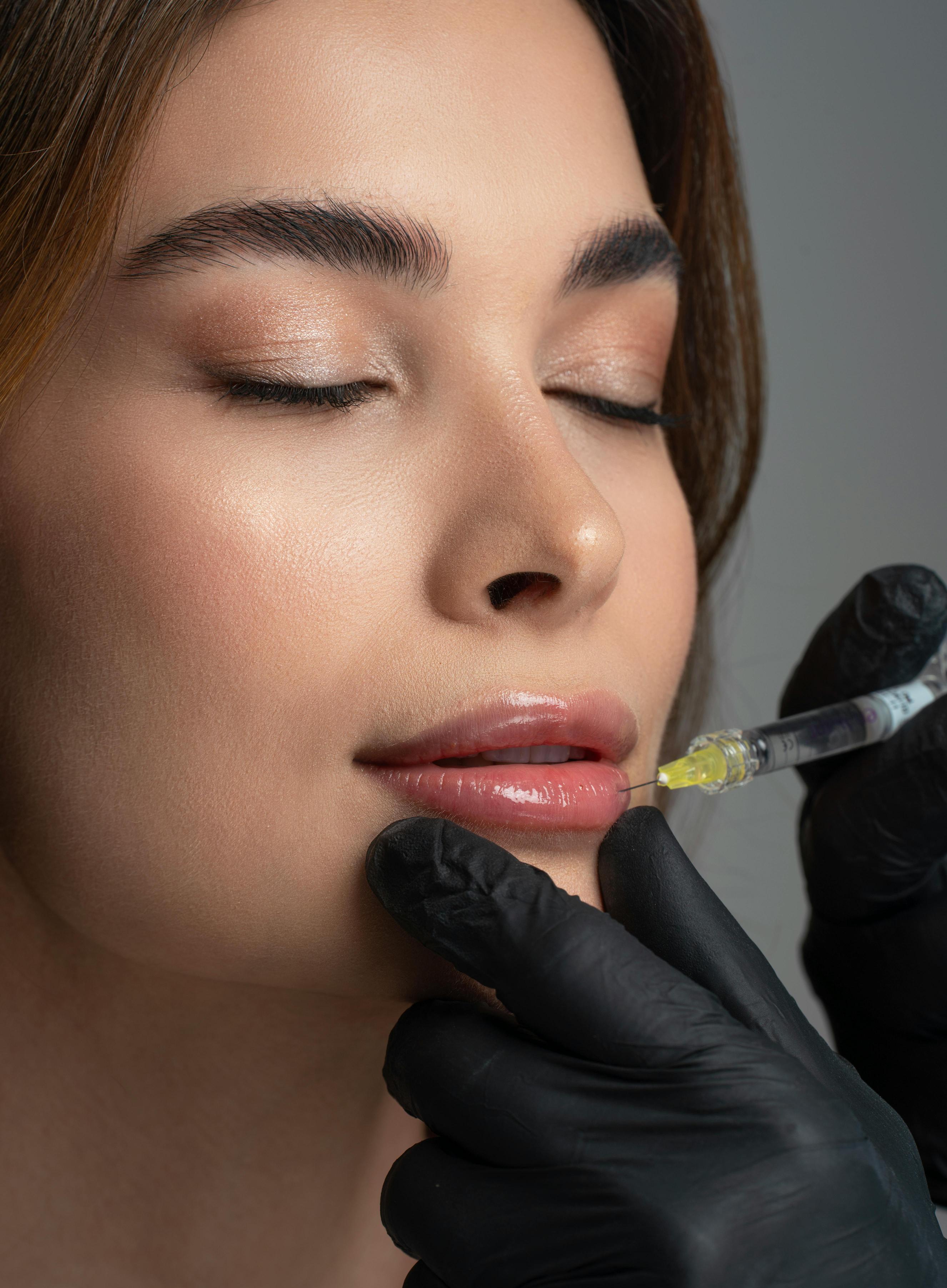 أصبحت تقنية Skin Boosters  من أبرز البدائل للنساء اللواتي لا يرغبن في تكبير الشفاه بشكل واضح