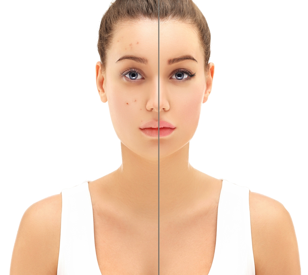 أما إذا كانت بشرتك جافة أو تفتقد الإشراقة، فاختيار مقشر يحتوي على لاكتيك أسيد سيكون مثالياً.