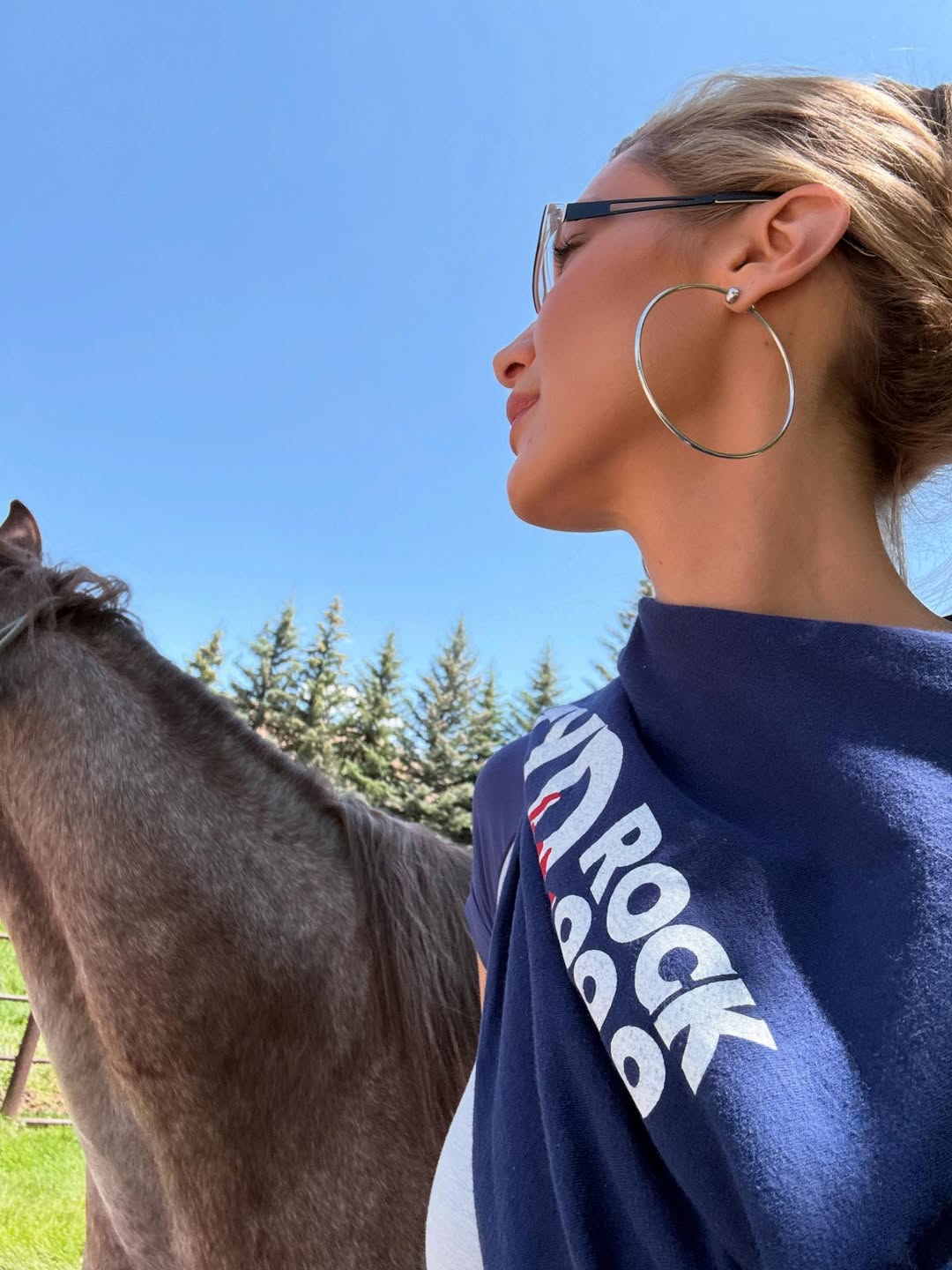 إزالة الدهون الوجنية من التقنيات التي يمكنك تطبيقها للحصول على وجه مثل بيلا حديد