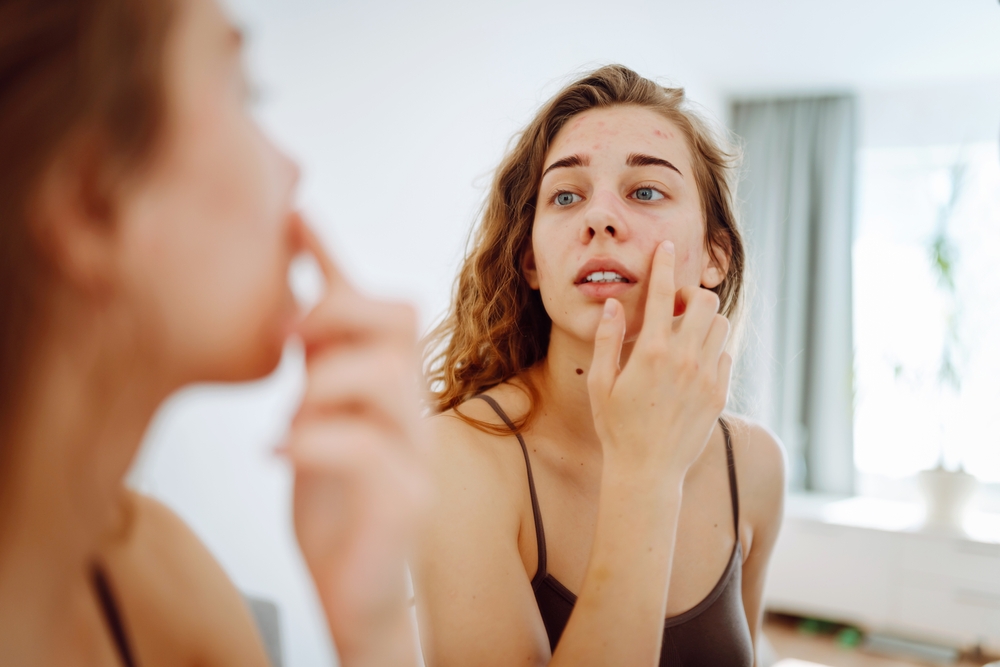 اختيار مرطبات بتركيبة جل أو لوشن تساعد في عدم  سدّ المسام