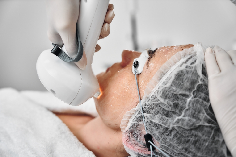 استخدام أشعة ضوء مكثف يساعد في توحيد لون البشرة