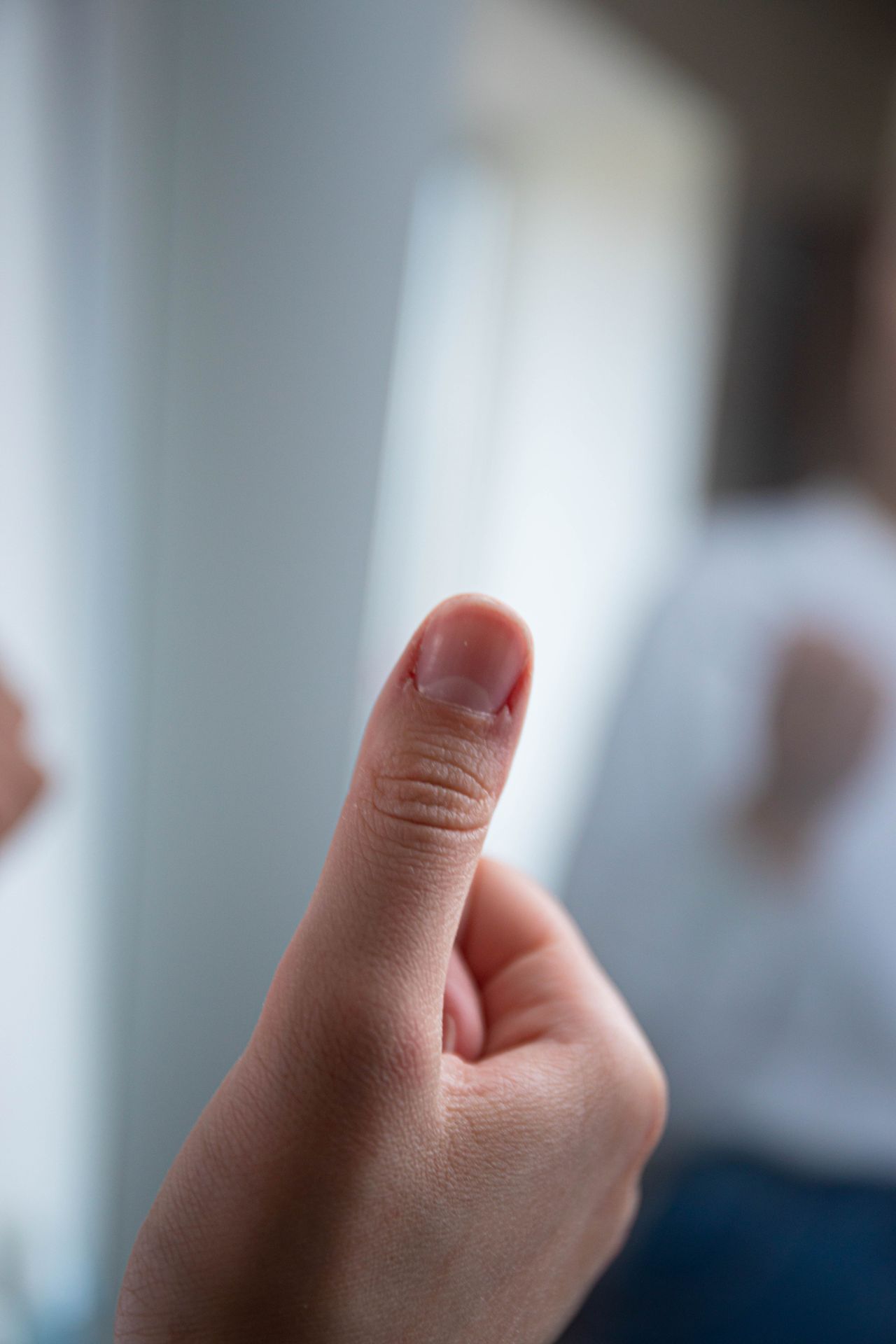 الأظافر أرق وأضعف فسيولوجيًا بعد العلاج الكيميائي تحديدًا