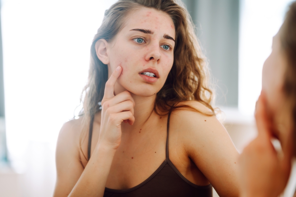 الاعتقاد بأن المرطب غير مناسب لبشرة المرأة الدهنية يعود غالباً إلى اختيار منتجات غير ملائمة