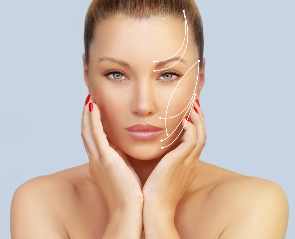 الخيوط التجميلية تُحفّز الجلد لإنتاج الكولاجين حول هذه الخيوط