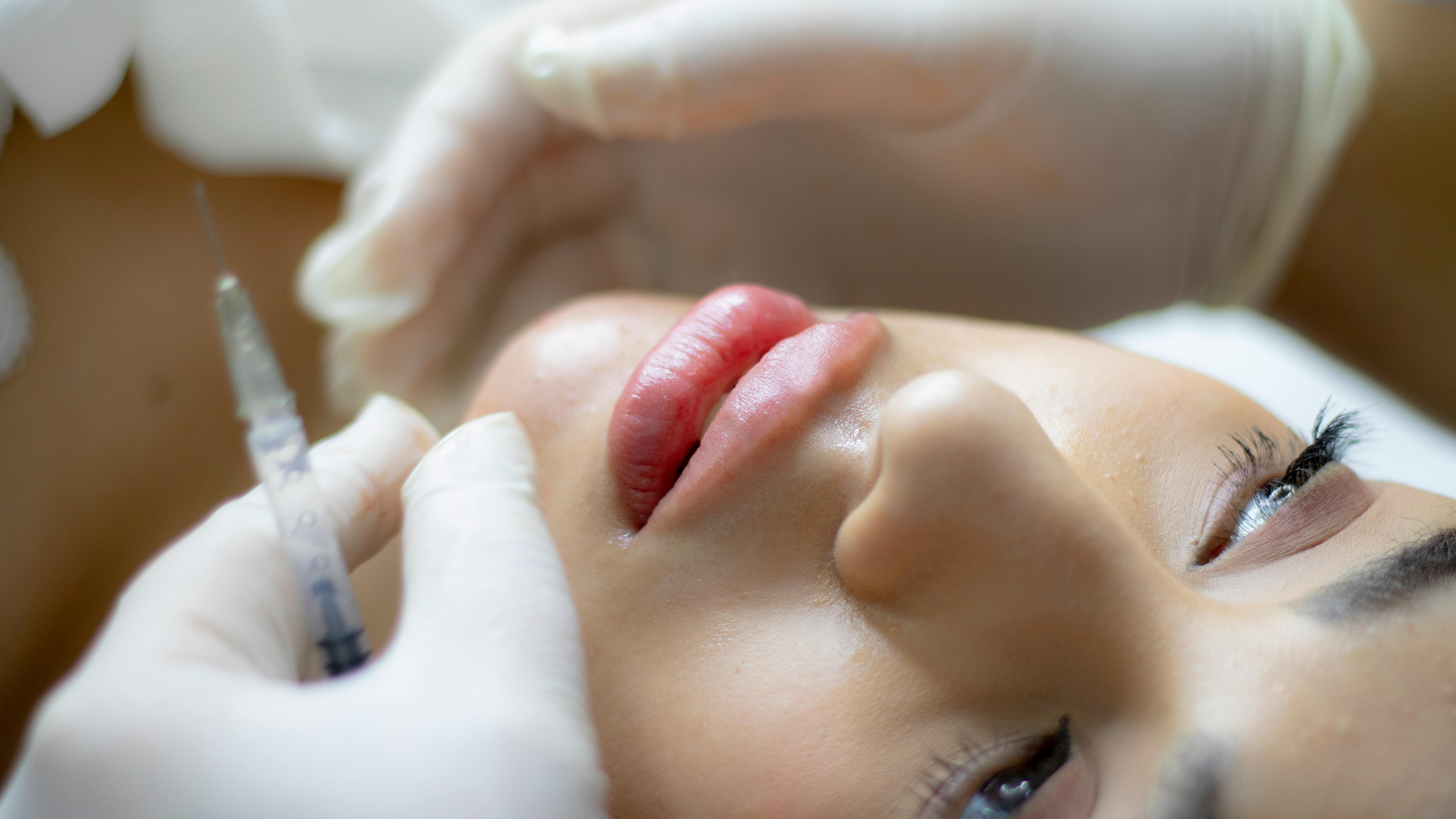 الفيلر أحدث صيحات الموضة التجميلية بين النساء