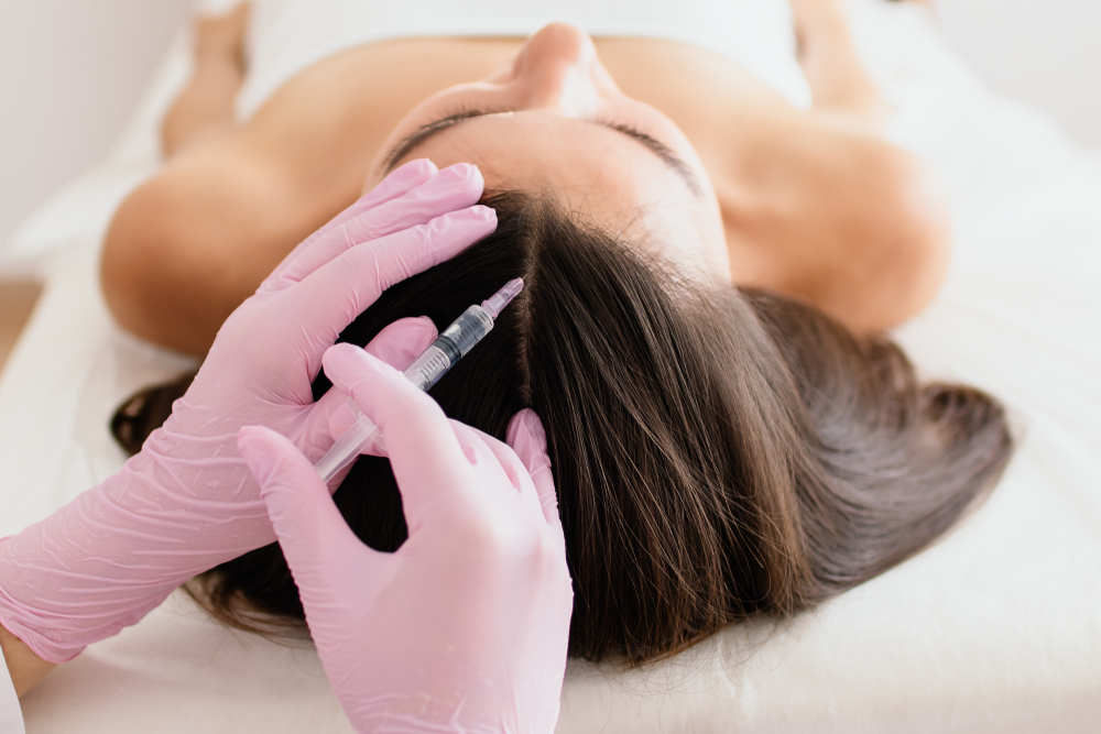 الفيلر العلاجي يطبق بطريقة الحقن الدقيقة في فروة الرأس