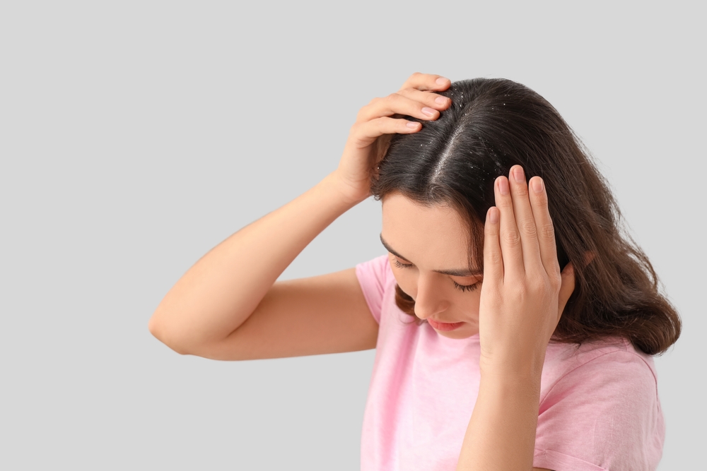 القشرة تسبب بشعر باهت يفتقر للمرونة