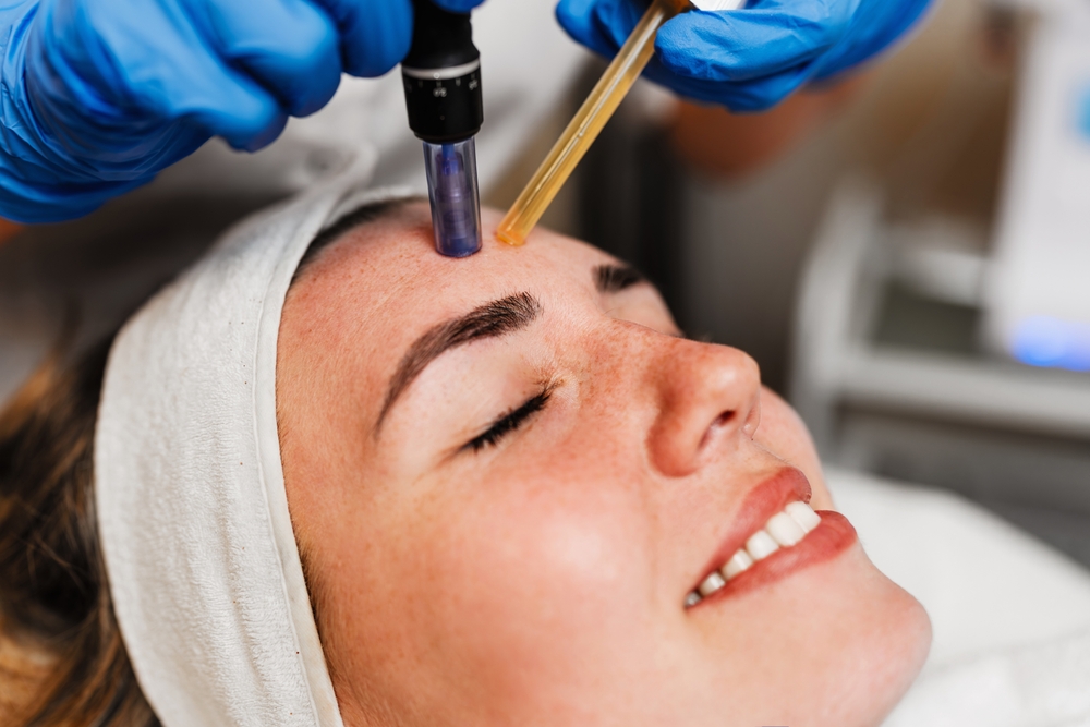 المايكرونيدلينج هو إجراء تجميلي دقيق يعتمد على الوخز بالإبر الدقيقة