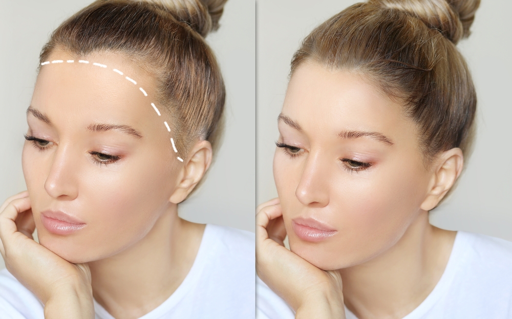 الميزة الأبرز لميكروبليدينغ خط الشعر  هي تحسين مظهر الفراغات الخفيفة