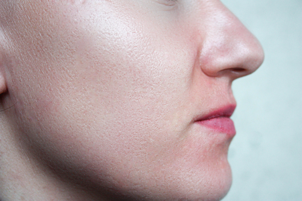 بعد التقشير ستحصلين على مسام نظيفة ومشدودة