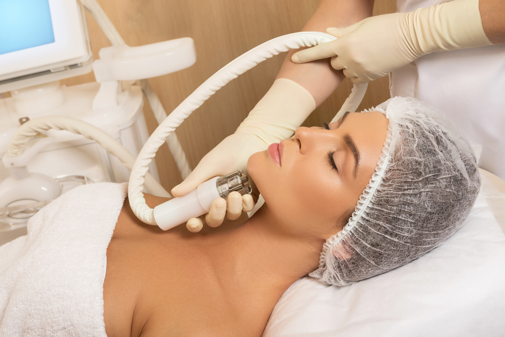 تجميد الدهون (CoolSculpting) حل فعّال لإزالة الذقن المزدوج دون جراحة