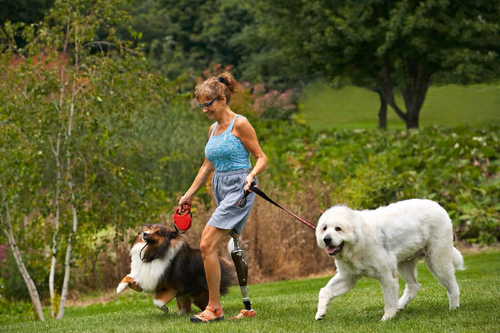 تستطيع المرأة الاستمتاع بحياتها اليومية بعد تركيب الطرف الصناعي.jpg