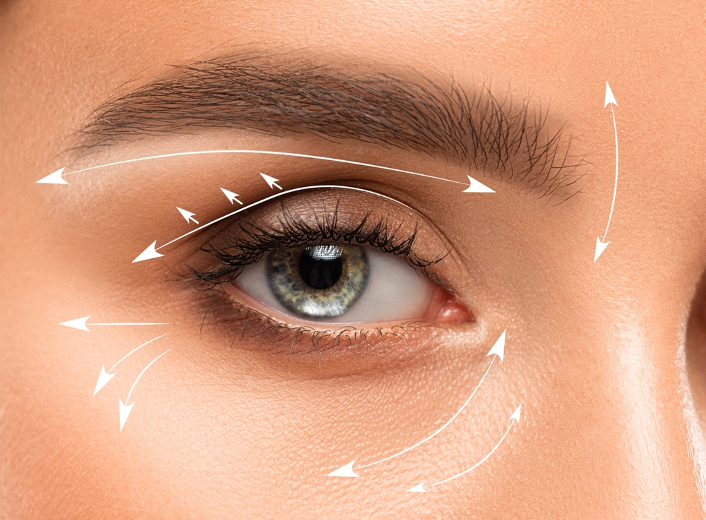تعتمد تقنيات شدّ الجلد بالطاقة الحرارية على تماسك الجلد حول العين تدريجياً