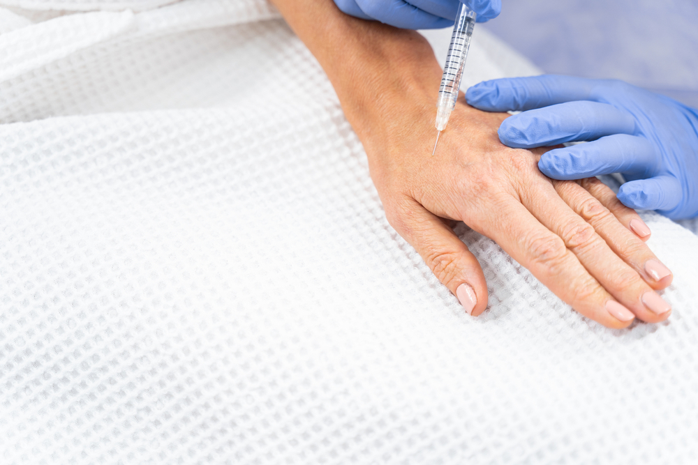 تعدّ حقن الفيلر من أكثر التقنيات تطوراً في تجديد اليدين