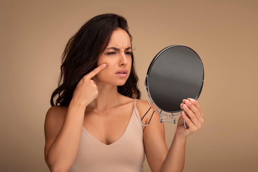 تعرّف الدكتورة لمى قسطنطين حب الشباب على أنه التهاب يصيب الغدد الزهمية الموجودة في الجلد