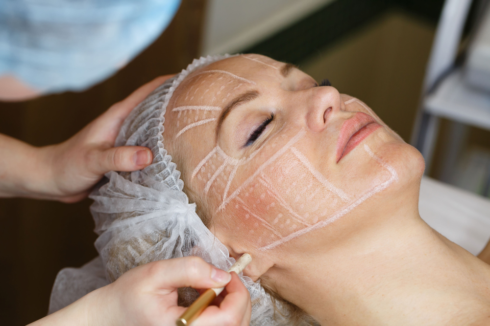 تقنية الـMini Facelift من أبرز التقنيات المستخدمة اليوم في حالات شدّ الوجه المبكر