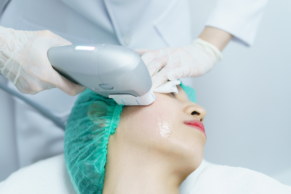 تقنية المورفيوس 8 (Morpheus8) تُعد من أحدث تقنيات شدّ البشرة غير الجراحية