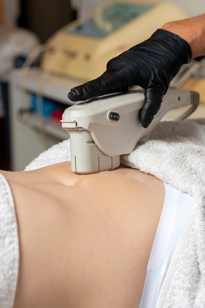 تقنية الهايفو لا تحتاج إلى تخدير أو شقوق