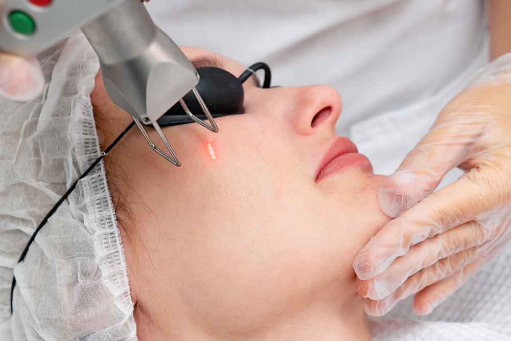 تقنية NeoGen Plasma لاستهداف طبقات محددة من الجلد دون إحداث جروح