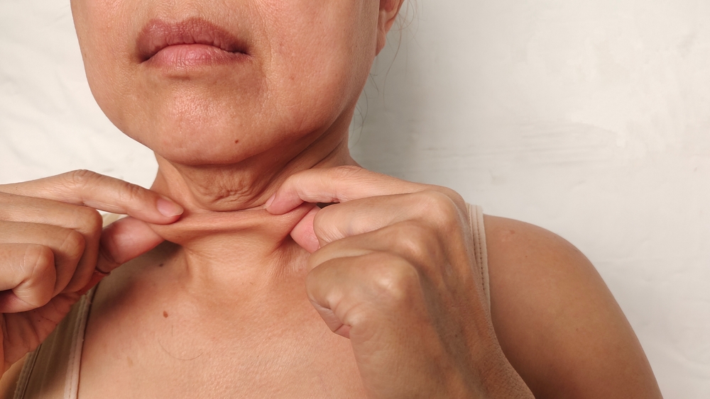 تلعب الوقاية دوراً مهماً في تقليل شدة الترهلات بعد العملية. فاتباع نمط حياة صحي منذ البداية