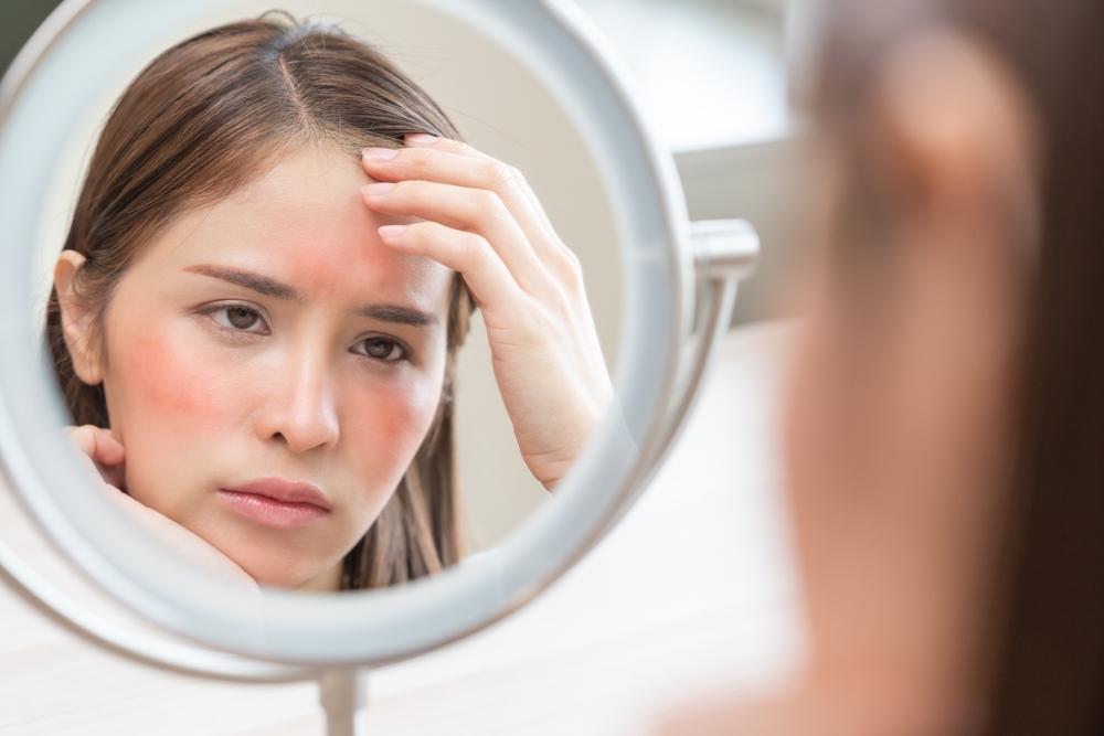 زيوت لعلاج اكزيما البشرة