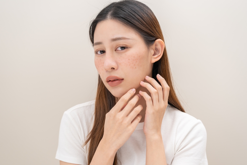 فيتامين د يدعم وظيفة الجلد ويقلل من فقدان الرطوبة