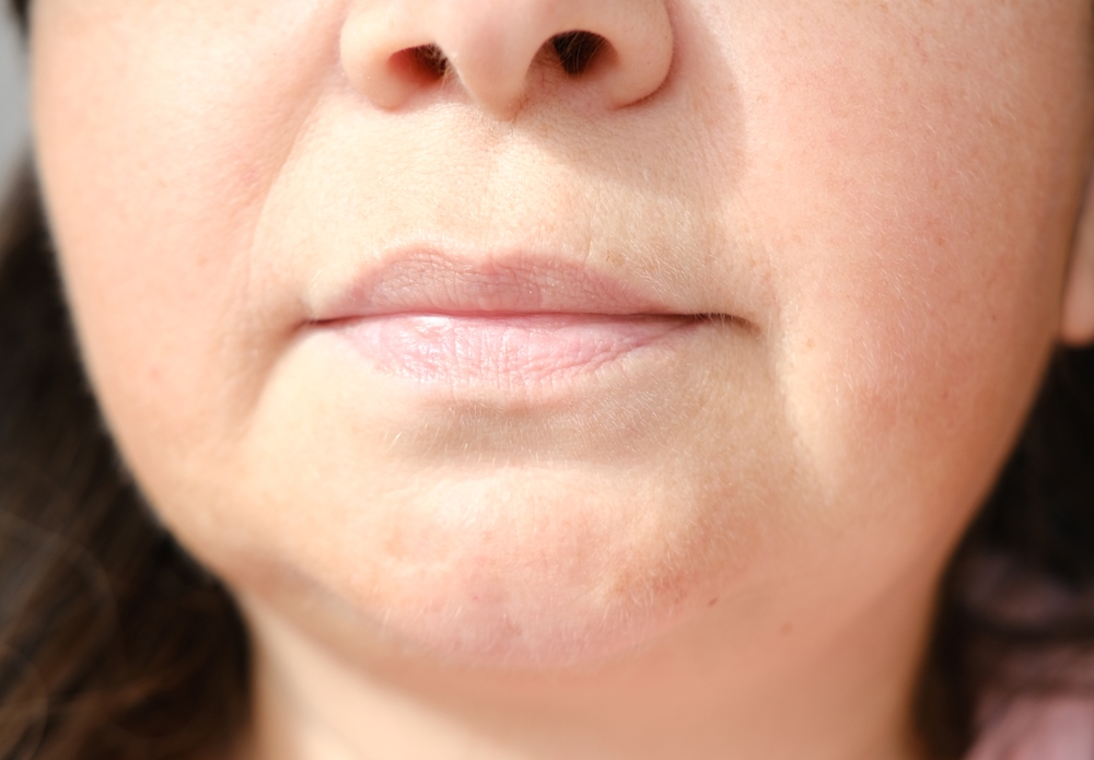 مع التقدم في العمر، يقل إفراز البروتينات المسؤولة عن مرونة الجلد وثباته، مما يجعل الخدود تفقد الامتلاء