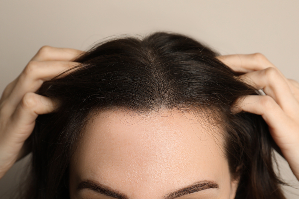 ميزوثيرابي الشعر هو أسلوب علاجي يتم تطبيقه عن طريق حقن الفيتامينات والمعادن والأحماض الأمينية اللازمة للشعر في فروة الرأس