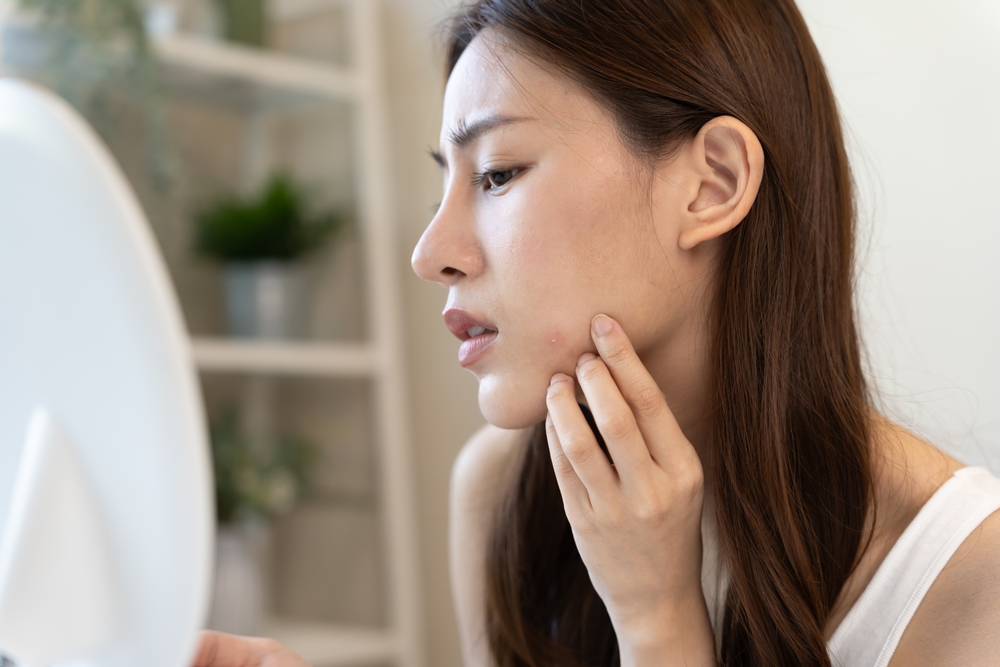 يساعد التقشير المنتظم بماسك البن على إزالة الدهون المتراكمة داخل المسام