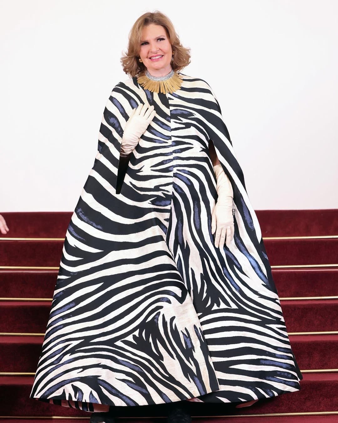  يسرا بثوب فضفاض باللون الابيض المطبوع بخطوط الزيبرا السوداء