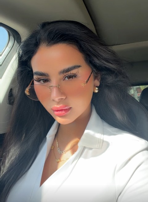 أحدث ظهور لمنة عرفة بعد خضوعها لعملية تجميل الأذن