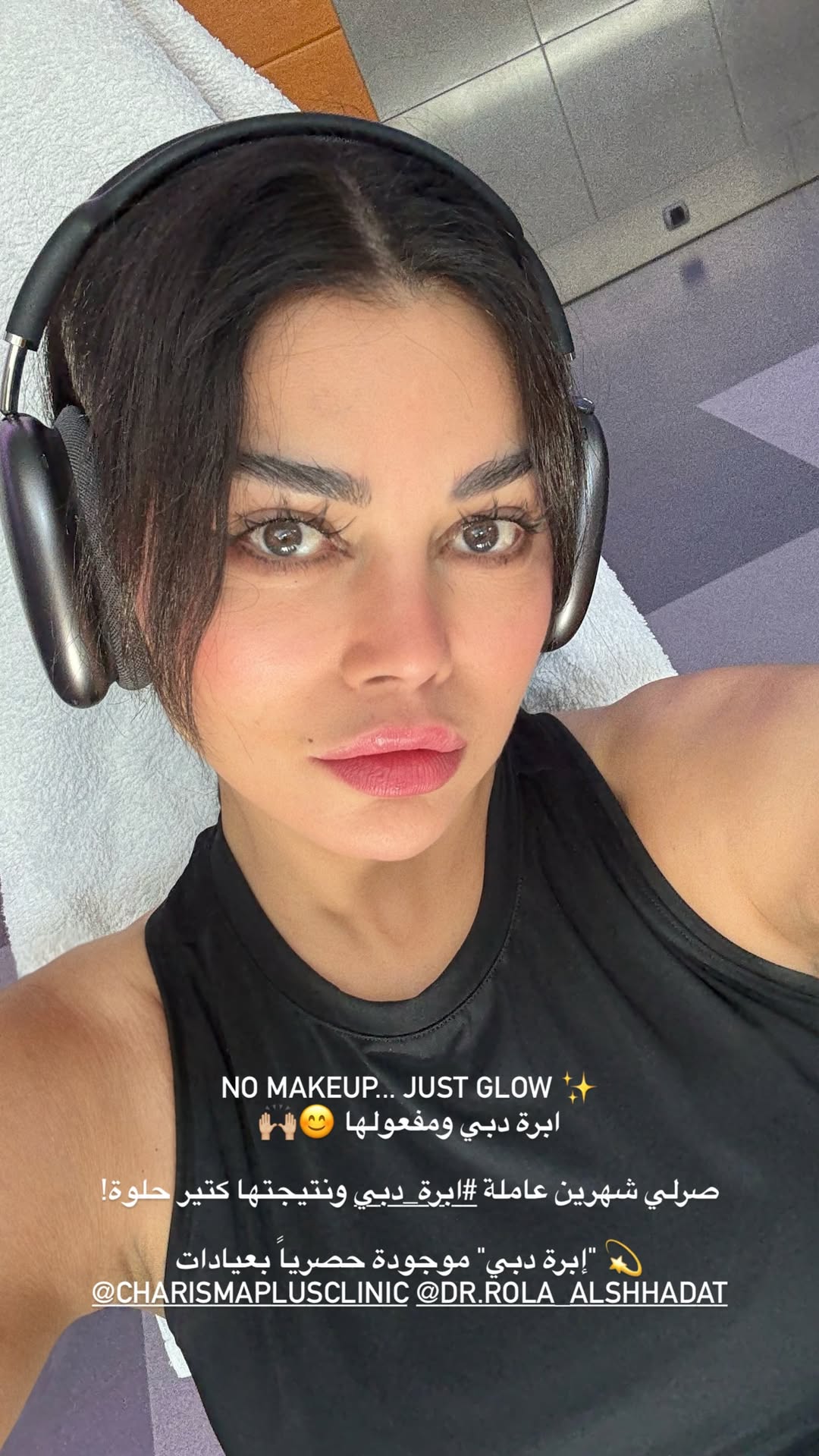 هيفاء وهبي تنشر صورتها بعد شهرين من خضوعها لإبرة دبي