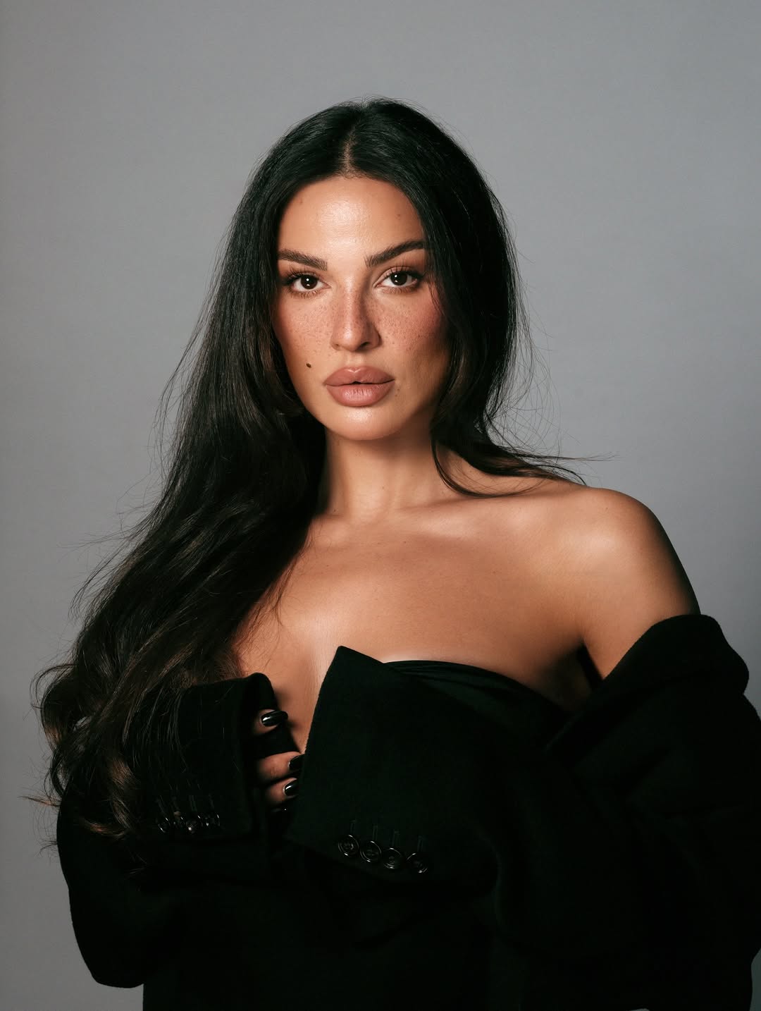 نادين نجيم وتكريس صيحة "النمش الطبيعي"