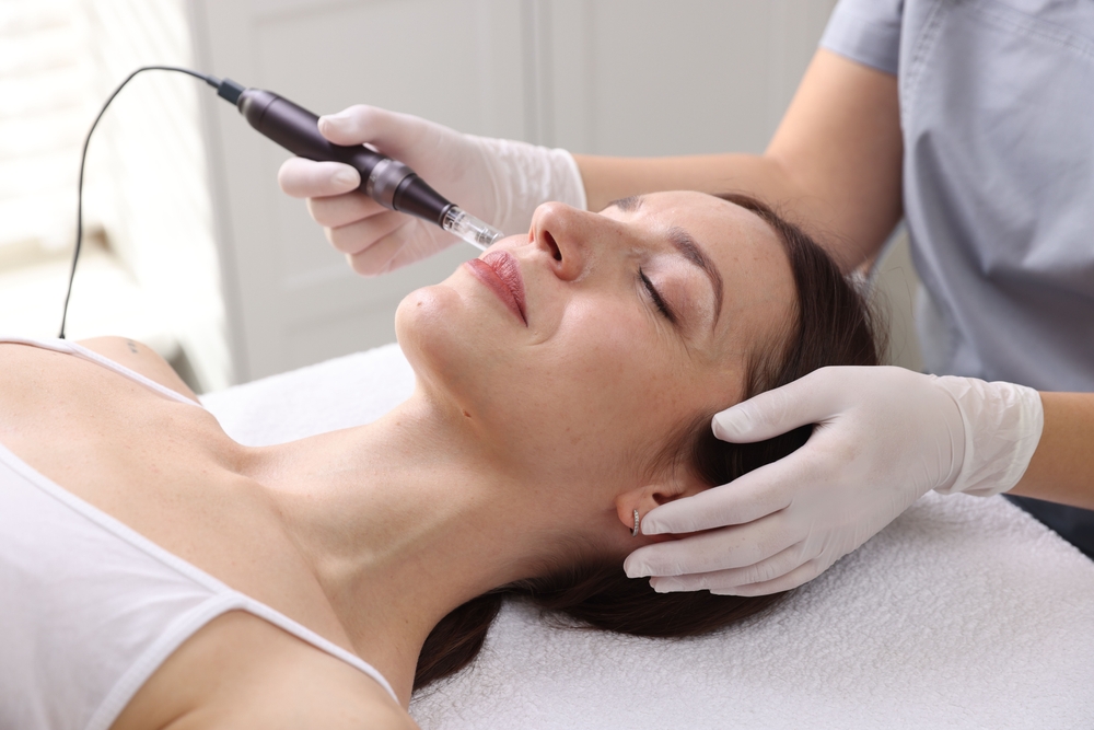 Microneedling لتحسين الملمس والخطوط الدقيقة