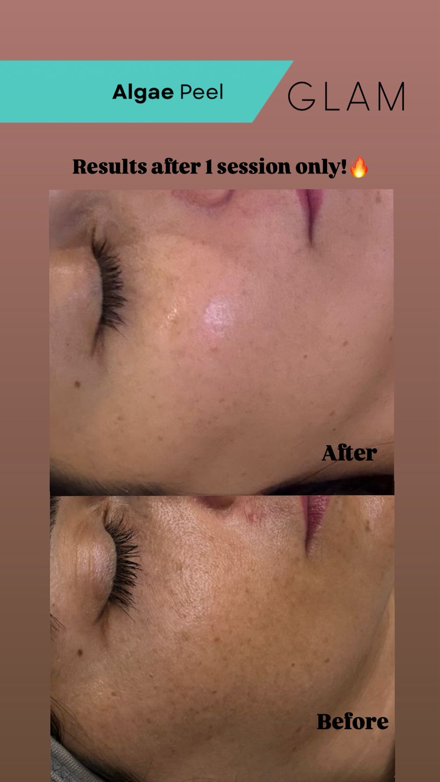 مميزات "تقشير الطحالب الطبيعي" للبشرة..الثورة الجديدة في عالم الجمال