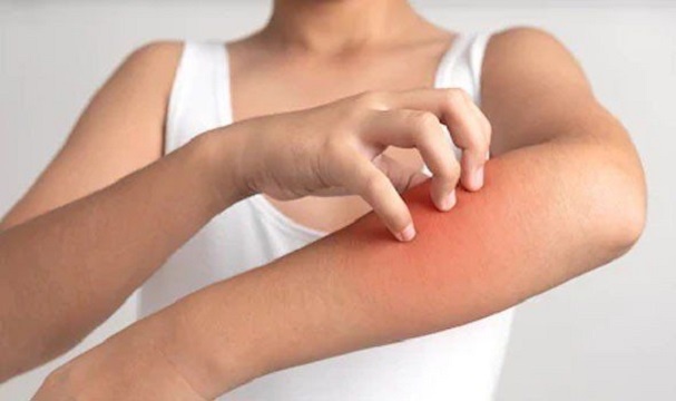 cover علاج حمرار وتهيج البشرة بعد إزالة الشعر