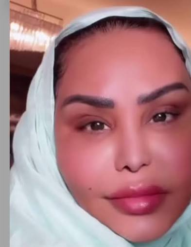 أحلام تكشف تفاصيل شد الوجه بدون جراحة.. Sofwave وNAD+ والسالمون والكالسيوم والبوتوكس