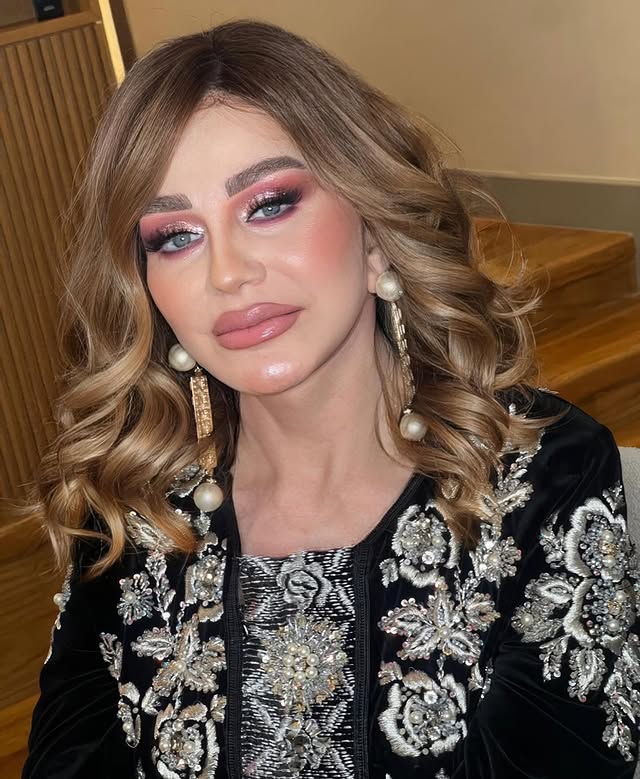 تغييرات جمالية في ملامح ميادة الحناوي في أحدث ظهور