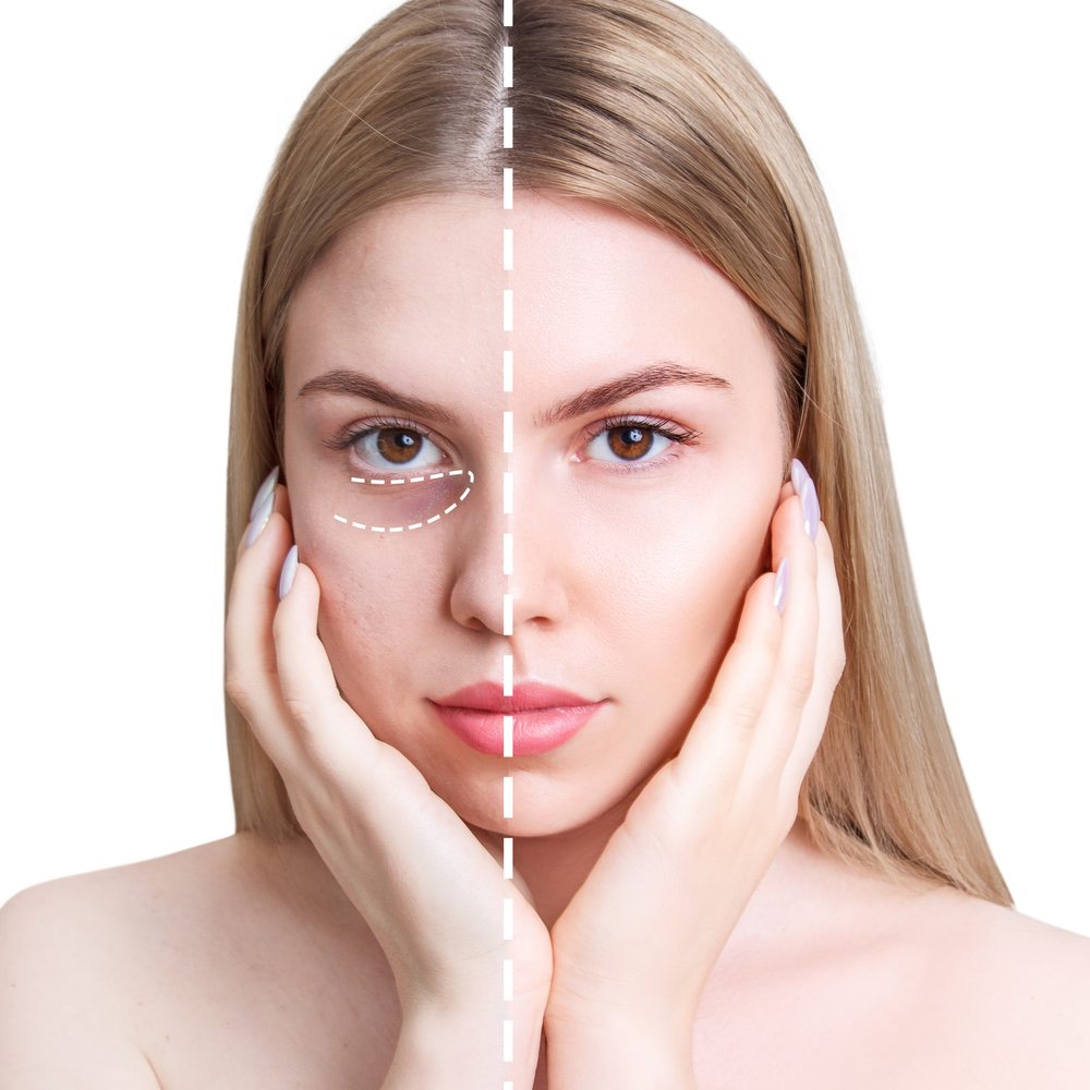 الحليب والهالات السوداء… ماذا يقول العلم؟