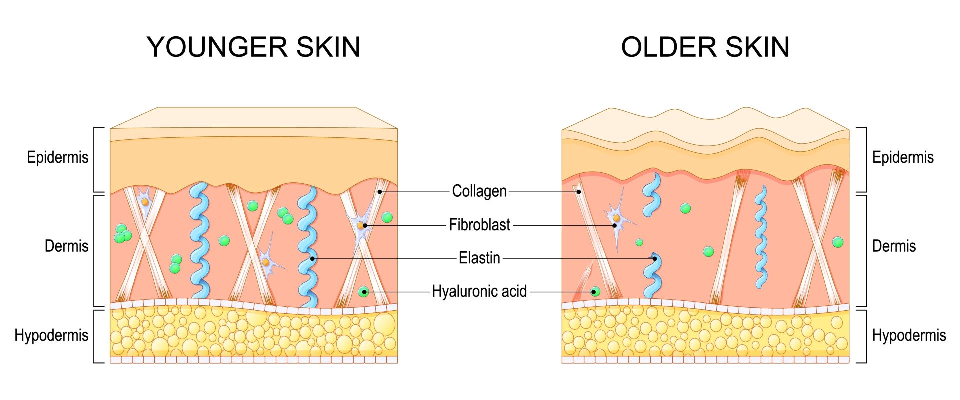 انخفاض مرونة الجلد قبل أي شيء آخر