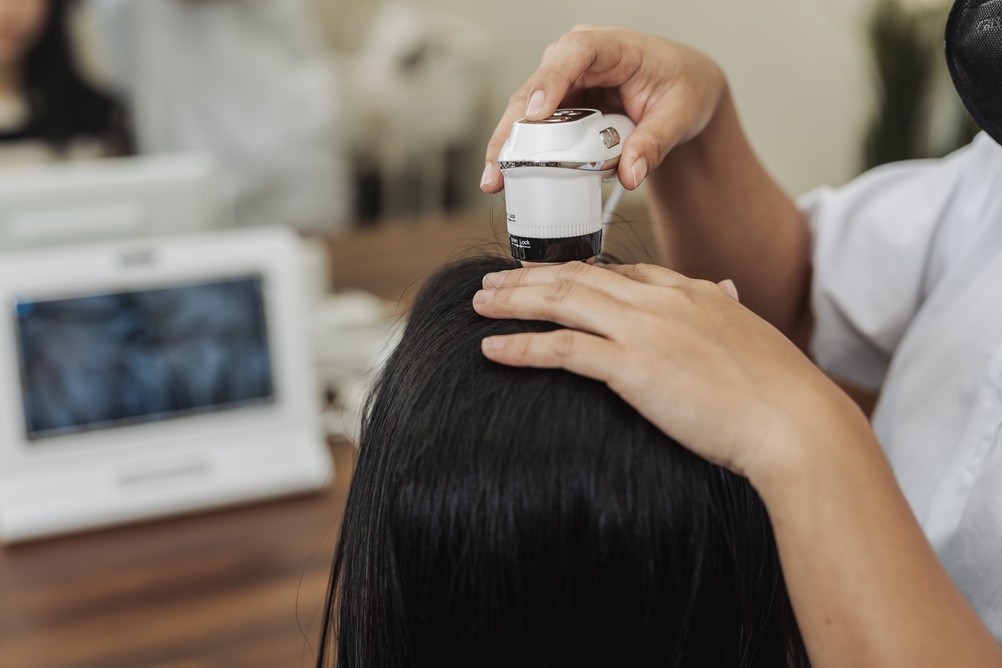 تقنية K-SCAN: تحليل رقمي للشعر وفروة الرأس