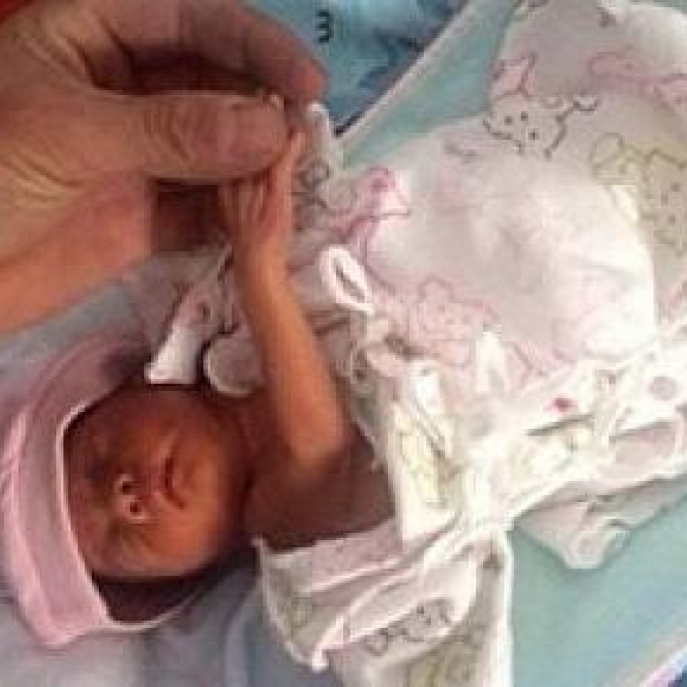 رضيعة تعود للحياة بعد دفنها!