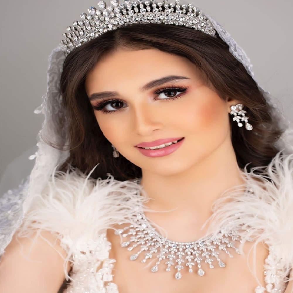 بعد الفستان الأبيض .. 5 حقائق مهمة عن الزواج لن يخبرك بها أحد