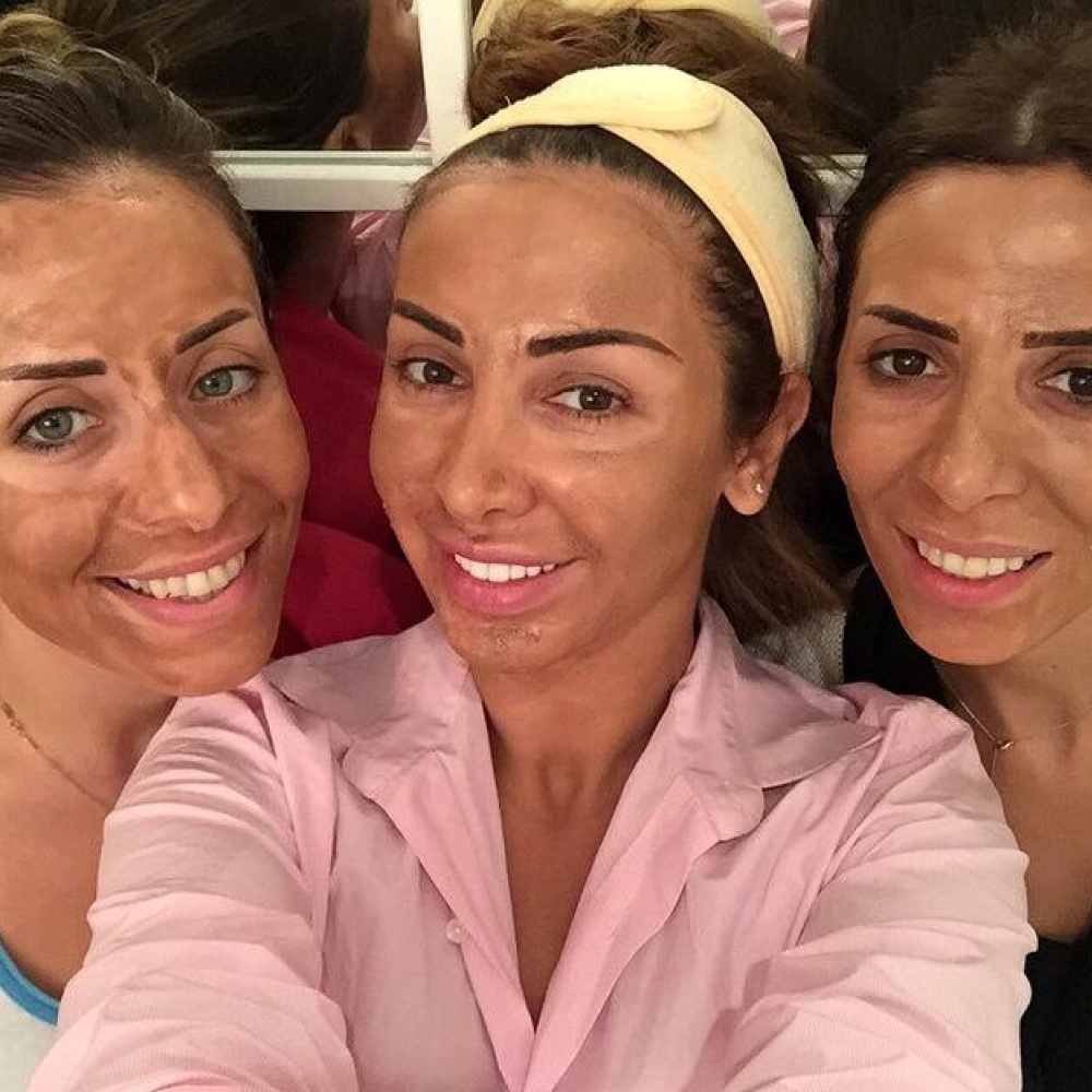 جويل تحاول استعادة نضارة بشرتها من خلال جلسة أقنعه للعناية ببشرتها مع صديقاتها