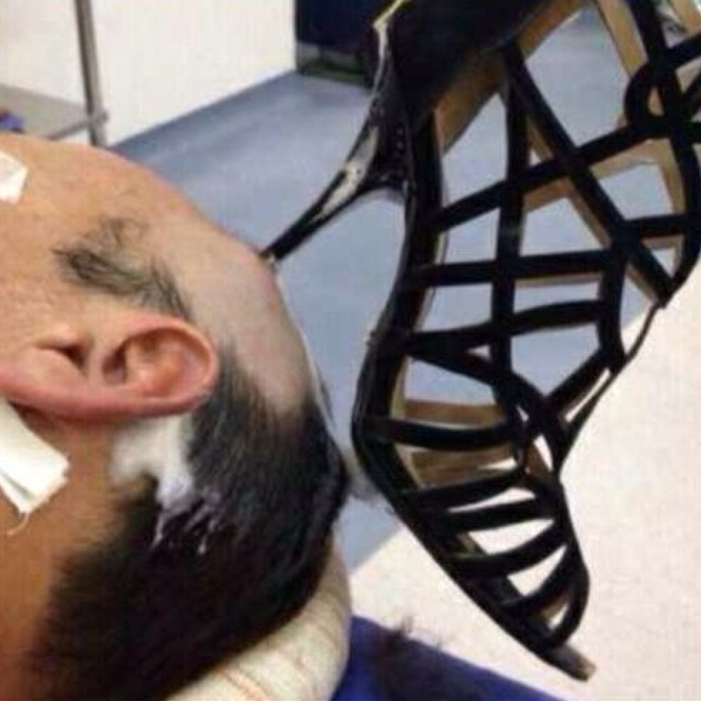 شجرة در سعودية تكاد تقتل زوجها بالحذاء