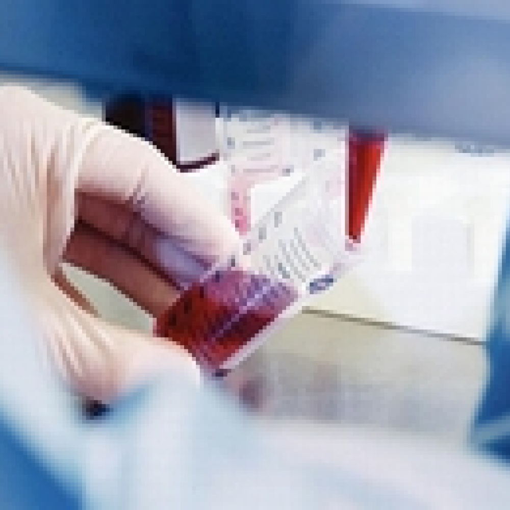 خلايا جذعية من بطانة الرحم قد تقضي على السكري