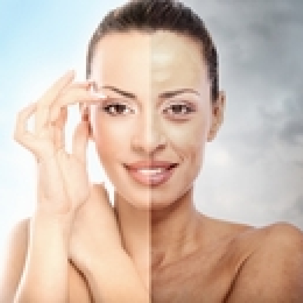 كيف تعالجين حب الشباب الموسمي