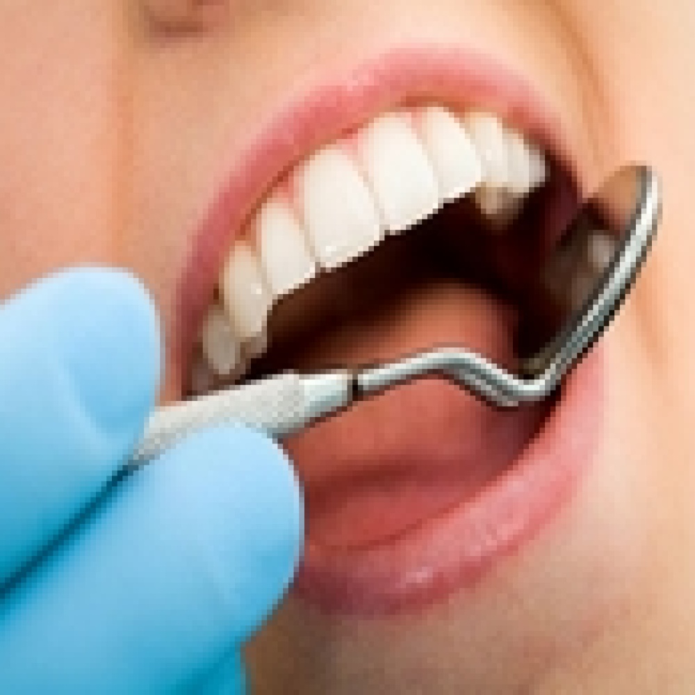 تقنية جديدة لتنظيف الأسنان بلا ألم