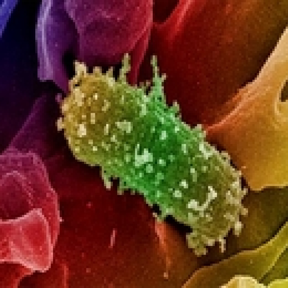 كيف نتجنب الإصابة ببكتيريا إي كولاي ؟