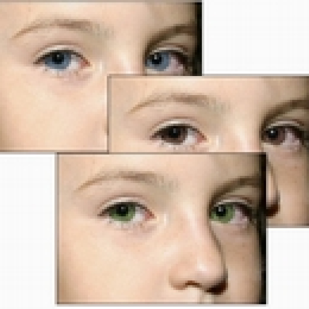 جراحة لتغيير لون العيون خلال 20 ثانية فقط